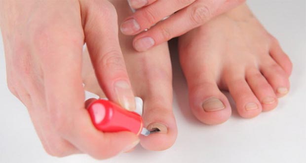 Від грибка на нігтях препарати: 15 кращих засобів від грибка нігтів на ногах. Рейтинг 2020