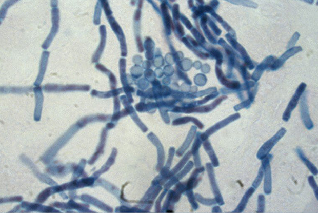 Дрожжеподобный условно-патогенный грибок