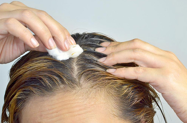 Лечение волосистой части головы