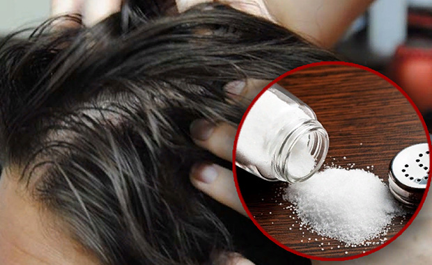 Лечение себореи головы солью